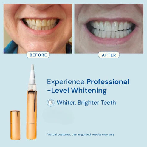 Helanvi™ Whitening Pen