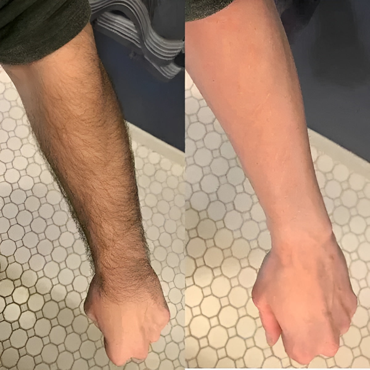 Helanvi Pain-Free Hair Removal Cream