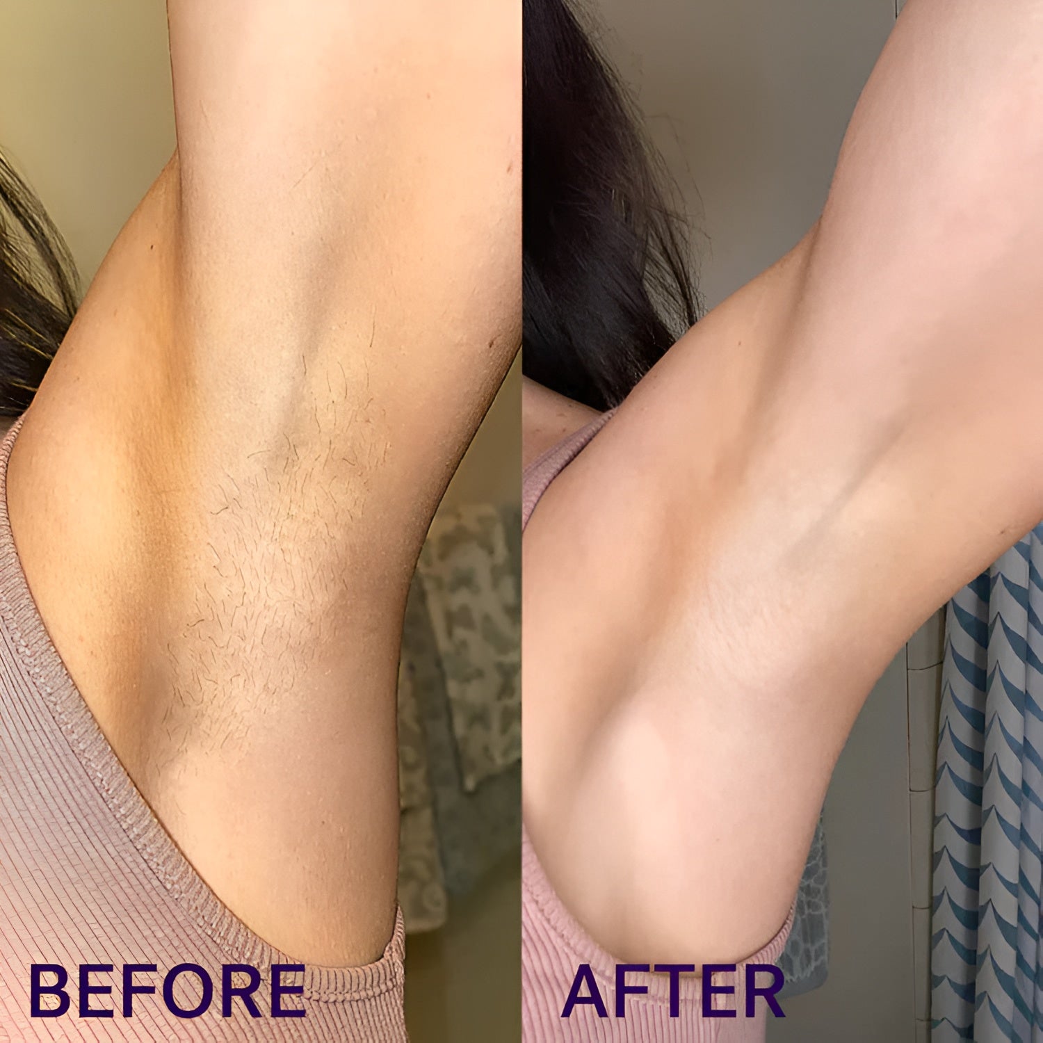 Helanvi Pain-Free Hair Removal Cream